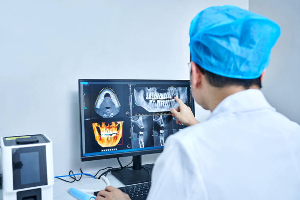 Best Knocked-Out Tooth (Avulsed Tooth) Treatment in Port Angeles East, WA