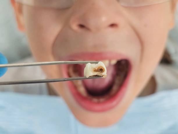 Best Emergency Orthodontic Repairs in Port Angeles East, WA