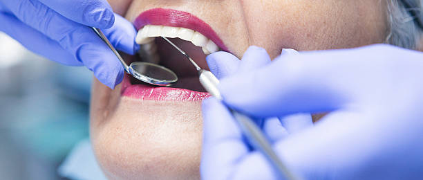 Best Dental Abscess Treatment in Port Angeles East, WA